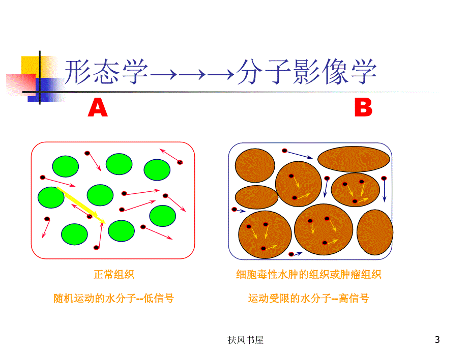 磁共振DWI的应用【业界优制】_第3页