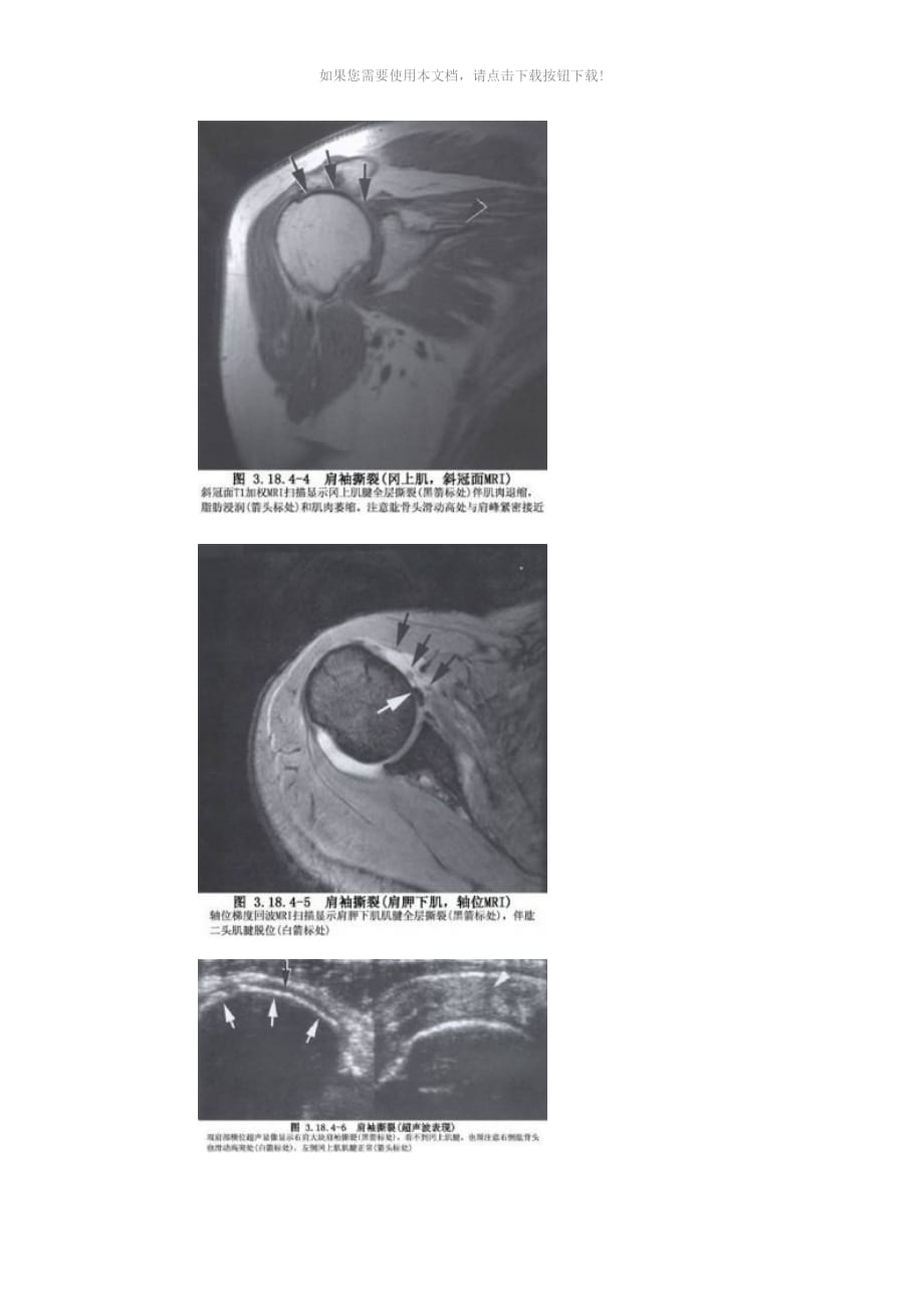 （推荐）肩关节镜概述_第3页