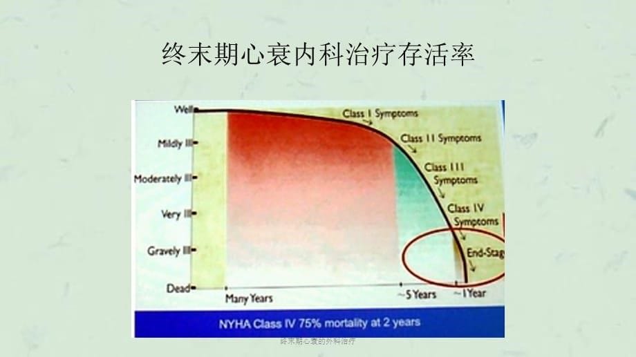 终末期心衰的外科治疗课件_第5页