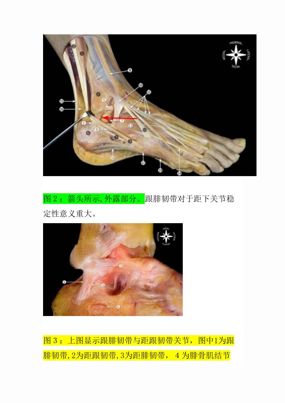 踝关节韧带解剖[1]_第4页