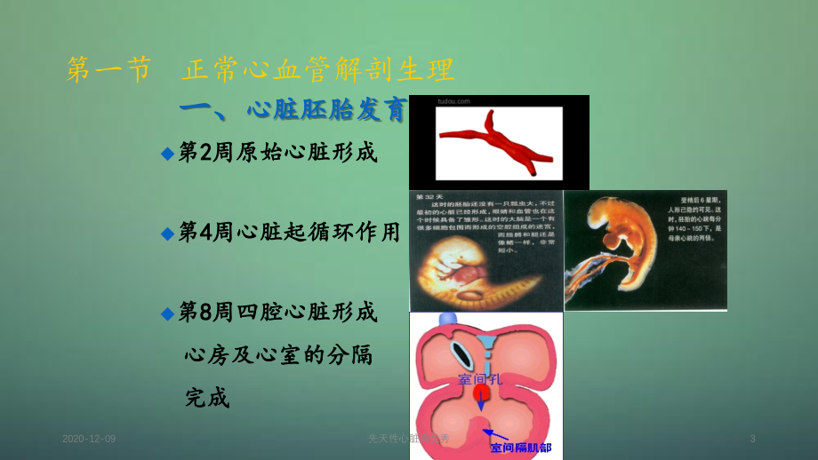 先天性心脏病优秀（精品收藏）_第3页