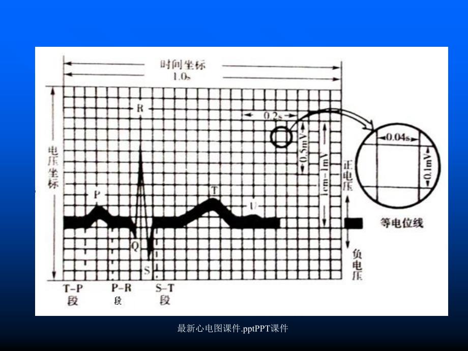 最新心电图课件.pptPPT课件_第3页