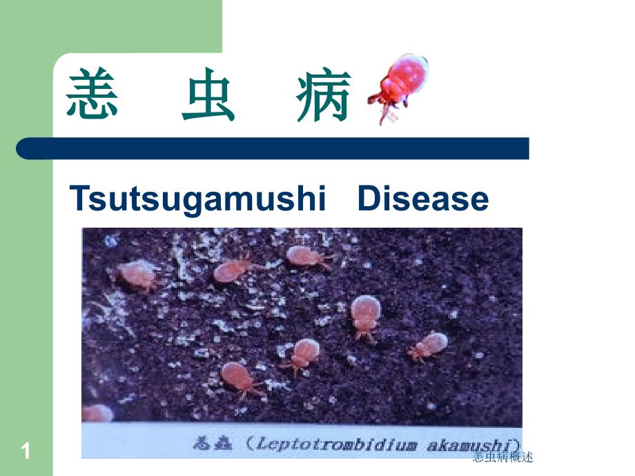 恙虫病概述（经典实用）_第1页