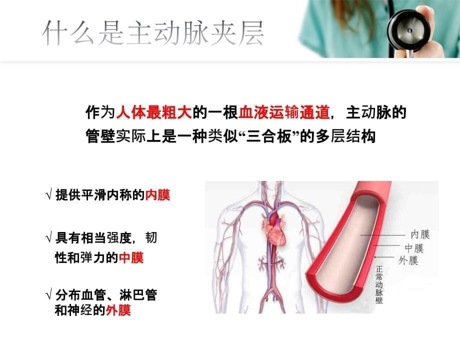 主动脉夹层优秀课件（经典实用）_第5页