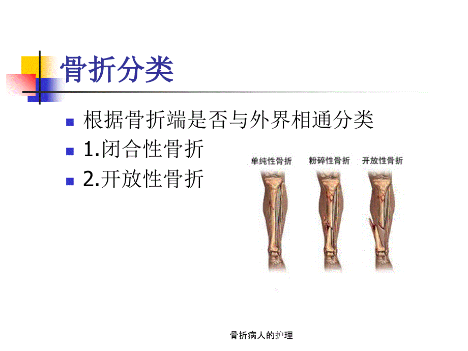 骨折病人的护理（经典实用）_第4页