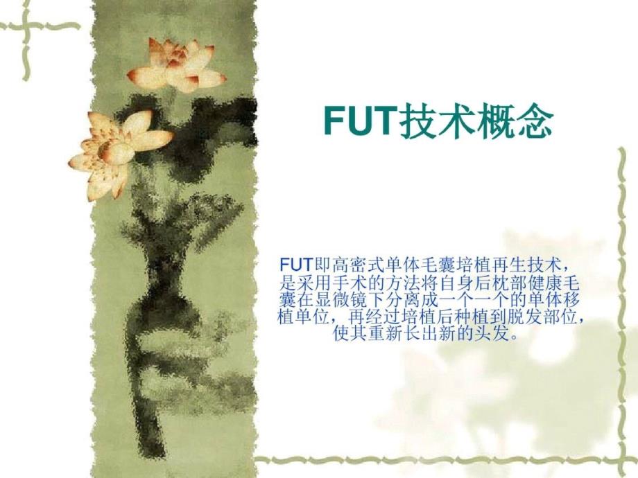 毛发移植FUT技术ppt课件[精选]_第2页