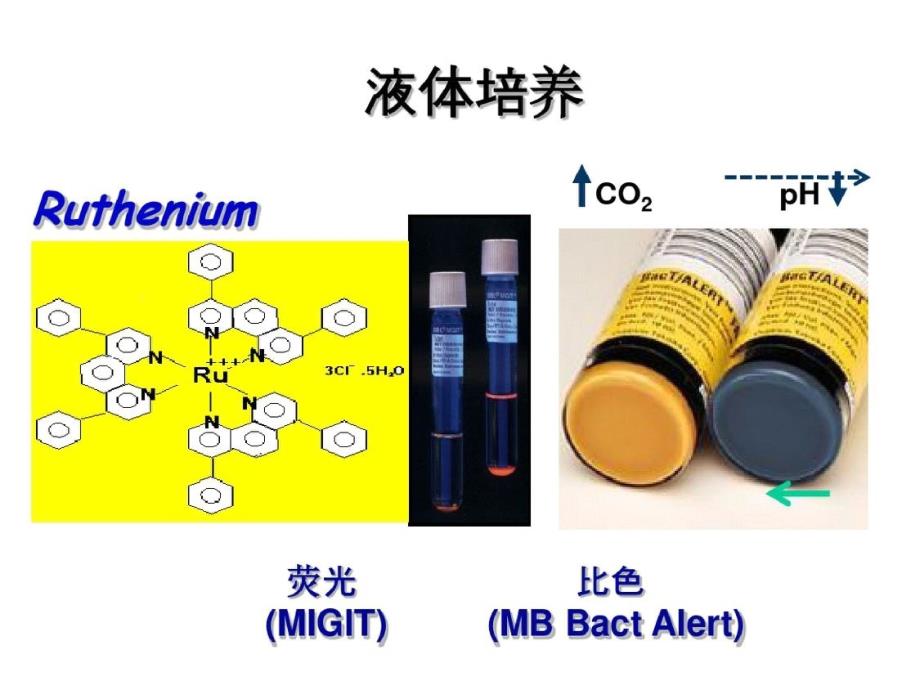 肺结核的新诊断技术ppt课件[精选]_第4页