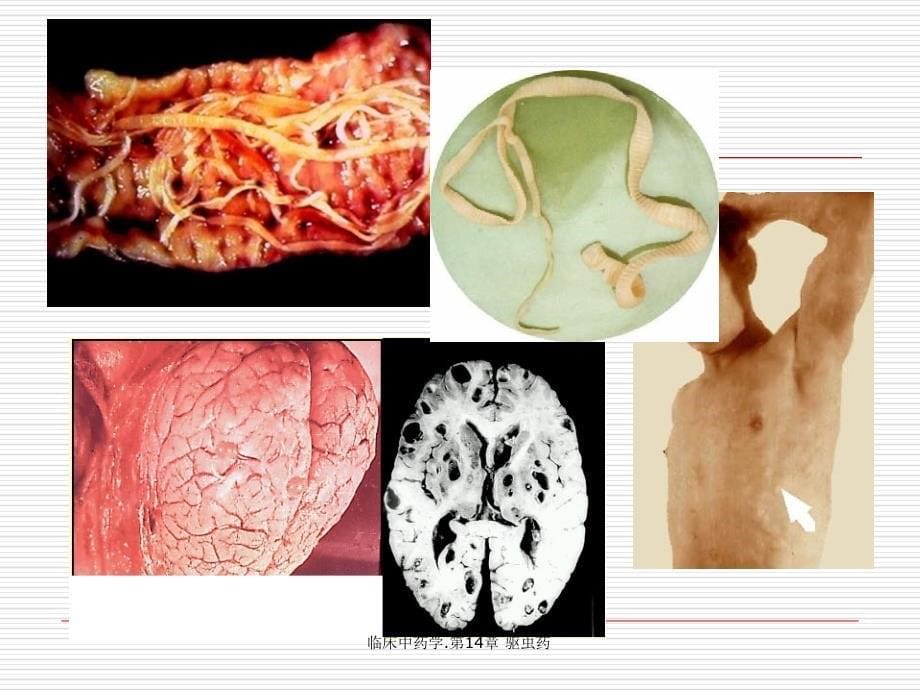 临床中药学.第14章 驱虫药（经典实用）_第5页