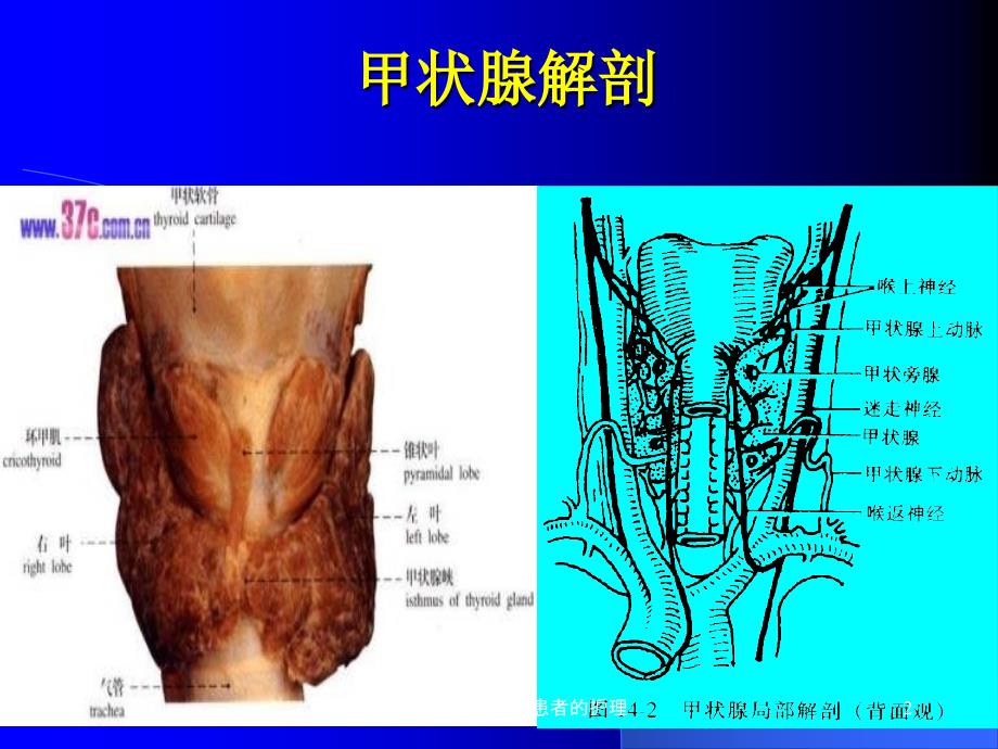 第十二章 颈部疾病患者的护理课件_第2页