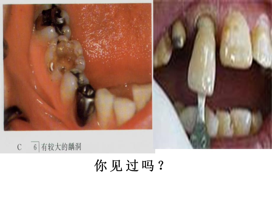 化学：第10单元第二节 化学元素与人体健康（共33张PPT）课件（鲁教版九年级）_第5页