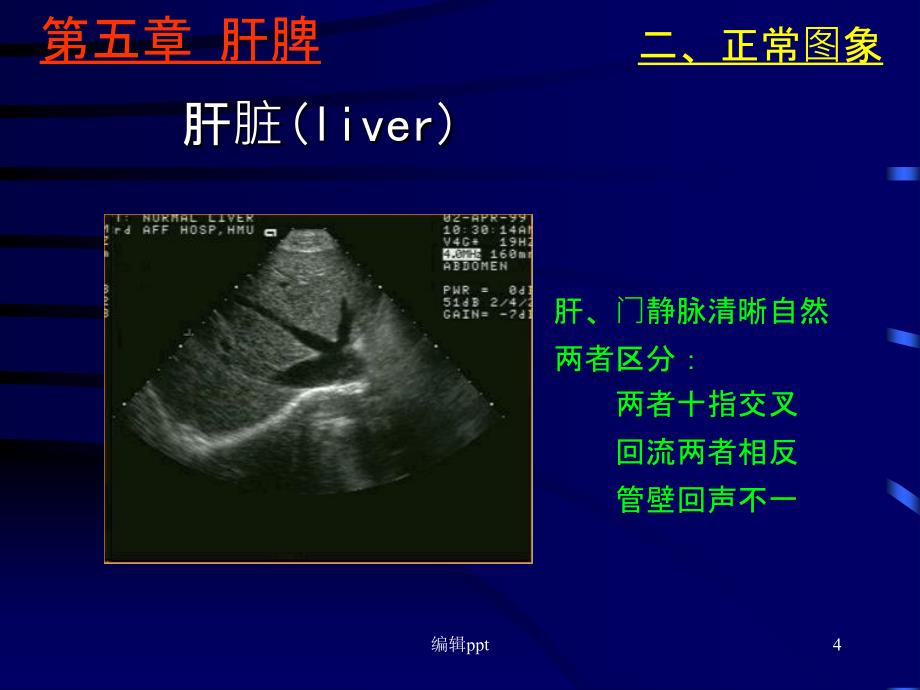 肝脏超声学(1)_第4页