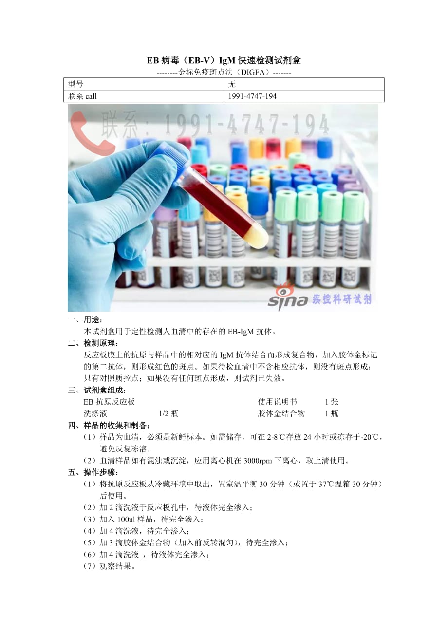 EB病毒（EB-V）IgM快速检测试剂盒_第1页
