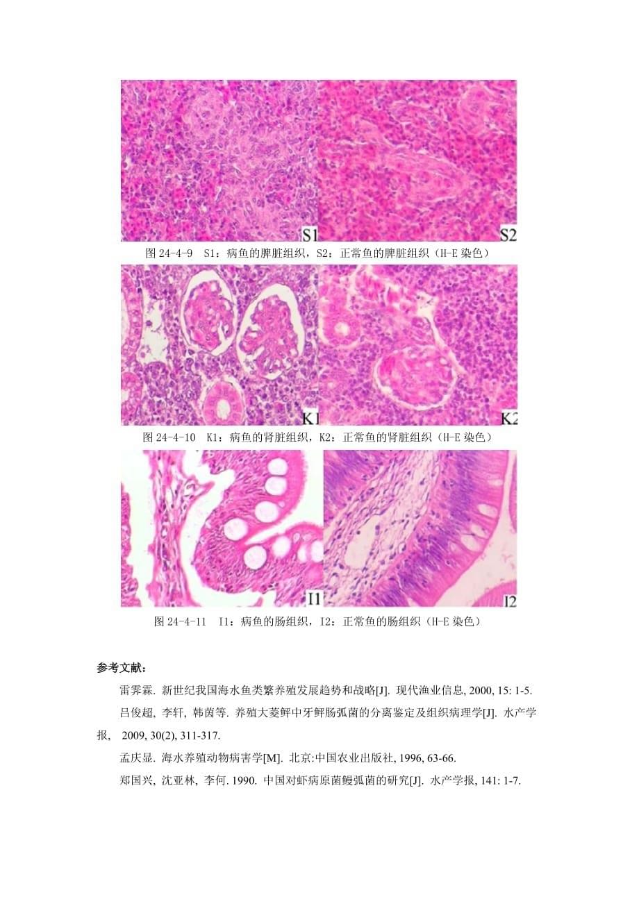 第二十四章 细菌性疾病病理_第5页