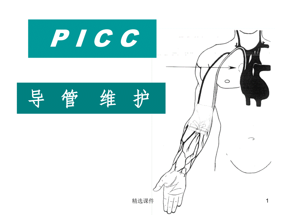 PICC导管维护(1)_第1页