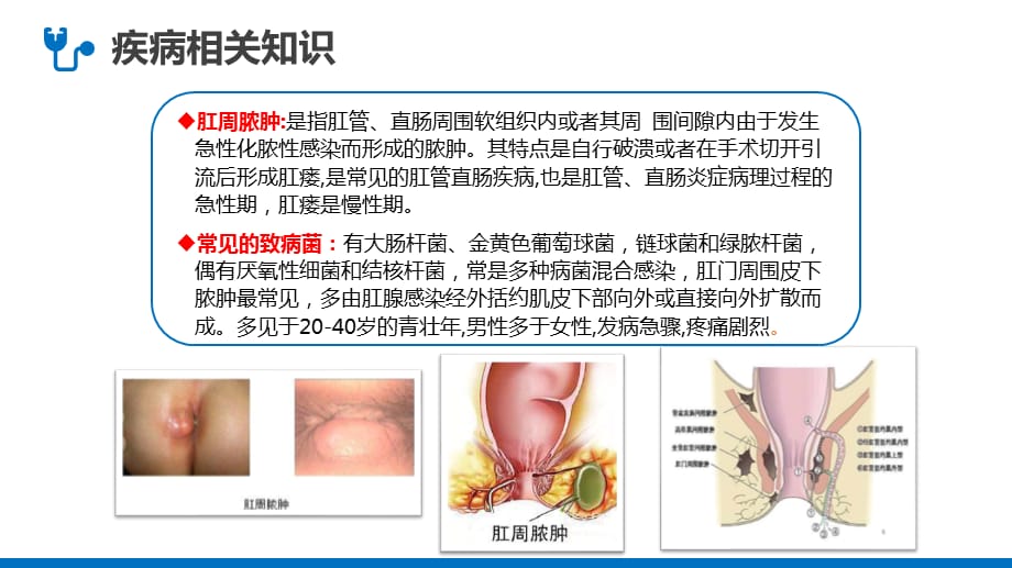 医院肛肠科护理查房医疗PPT授课课件_第4页