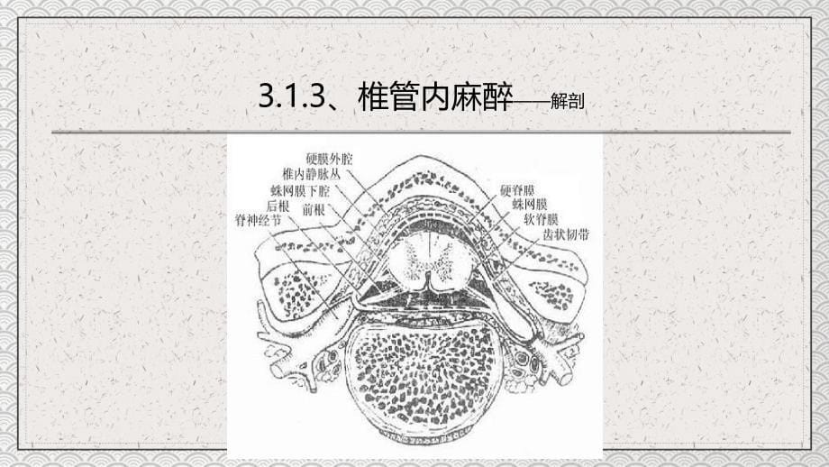 医疗教学之椎管内麻醉 PPT授课课件_第5页