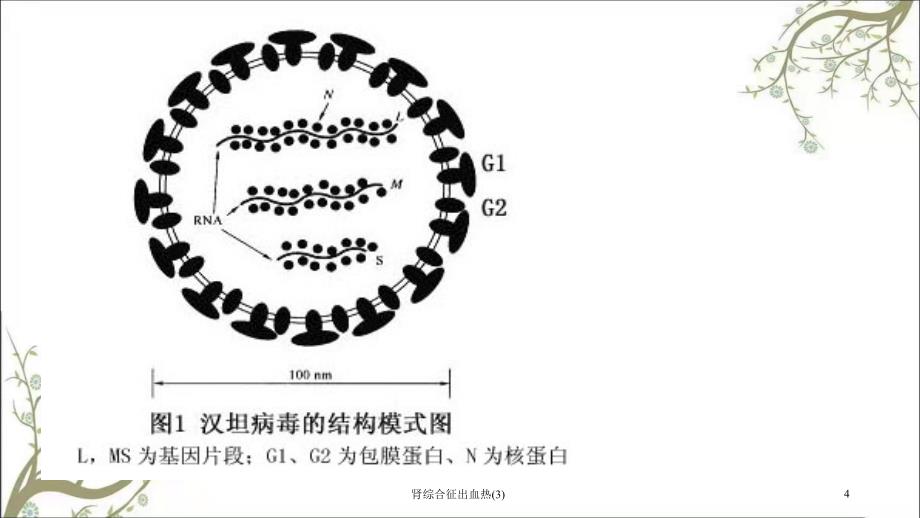 肾综合征出血热(3)课件_第4页