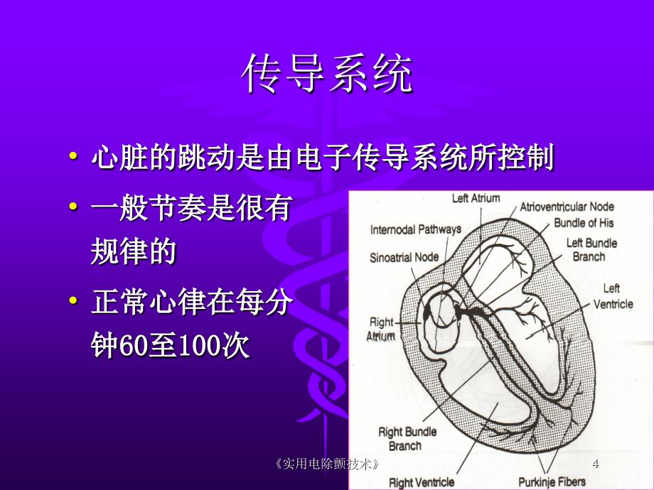 《实用电除颤技术》课件_第4页