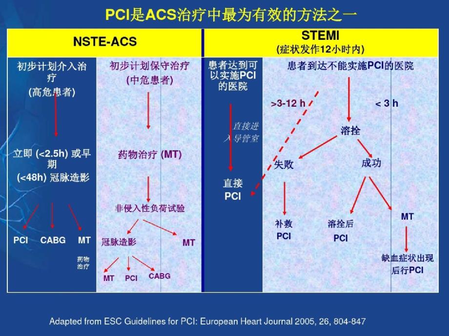 pci波立维讲义ppt[精选]_第4页