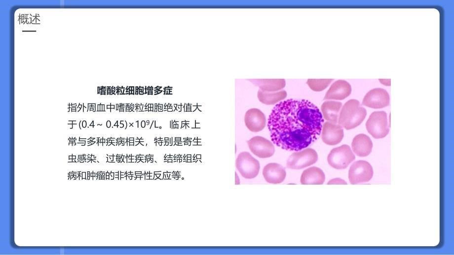 嗜酸细胞增多症PPT课件._第5页