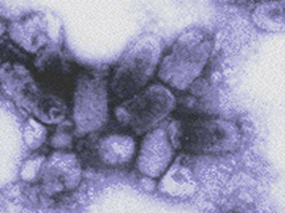 [精选]狂犬病病毒(Rabiesvirus)_第5页