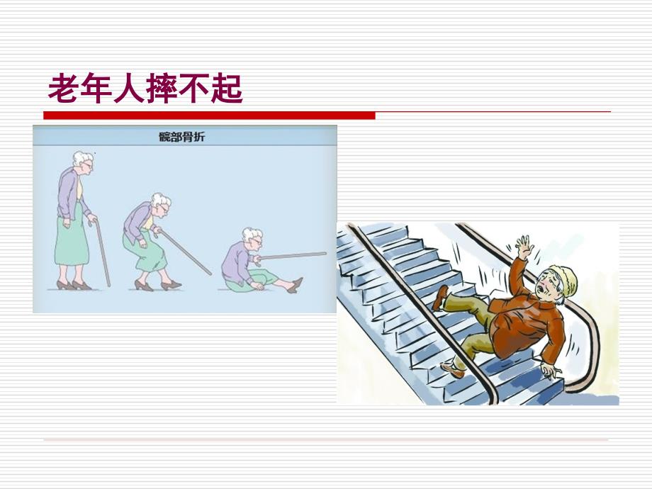 【手术护理】老年髋部骨折_第2页