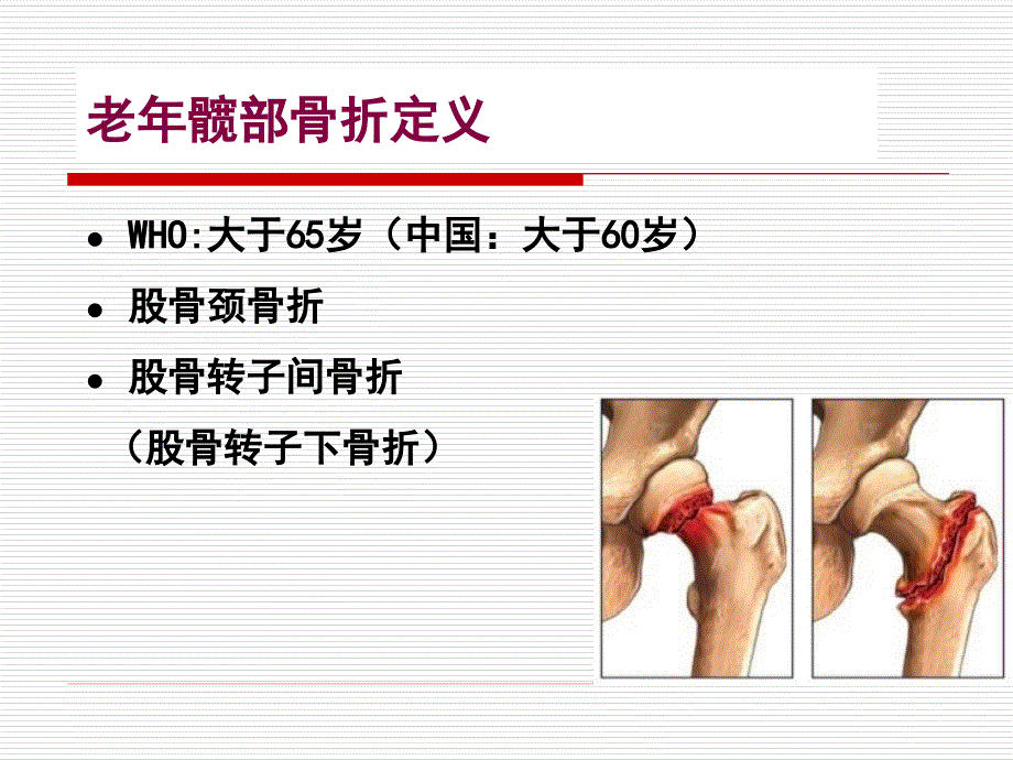 【手术护理】老年髋部骨折_第4页