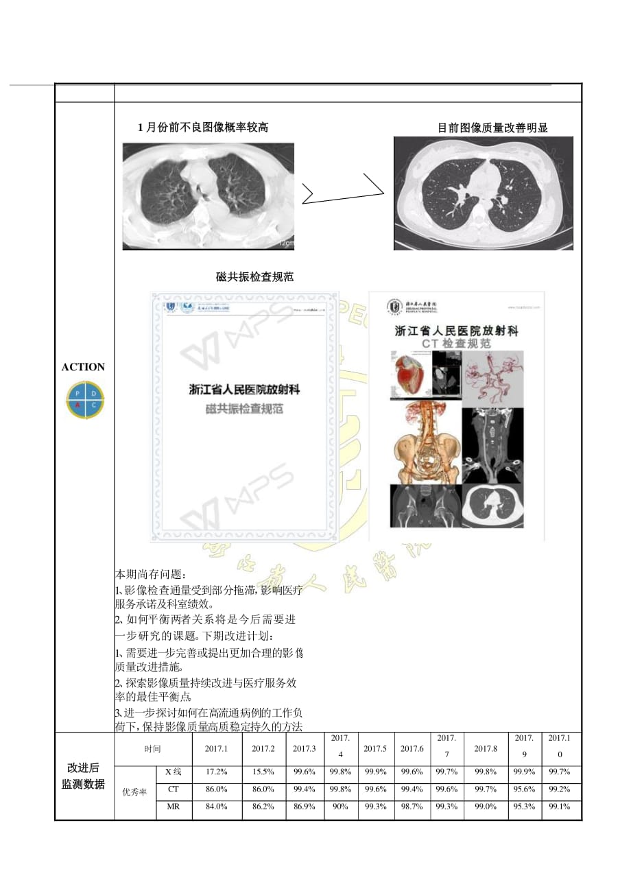 放射科-全样本影像质量评估改善放射科影像质量PDCA_第4页