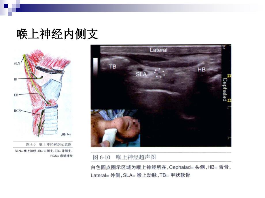 麻醉科培训－颈部超声解剖_第4页