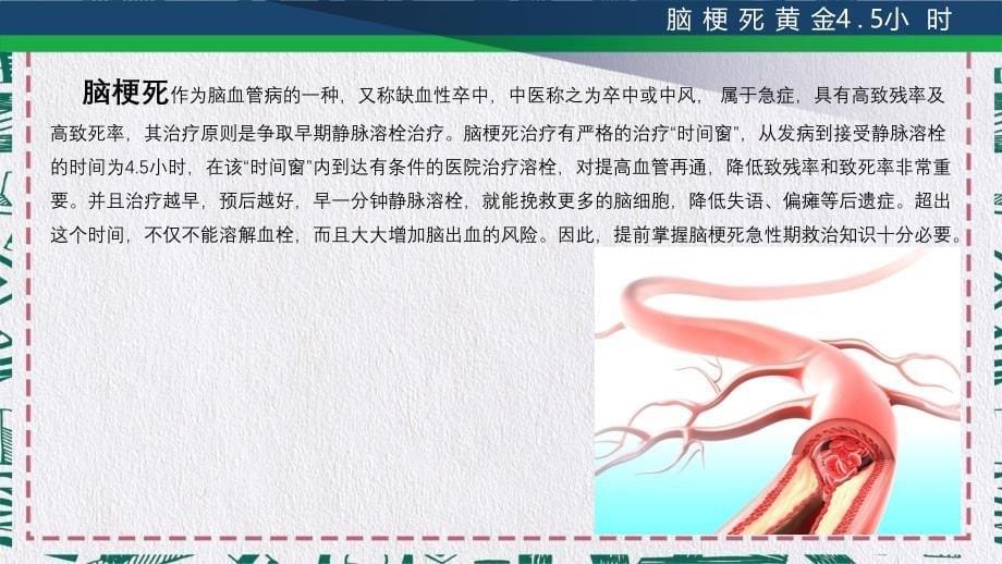 医院医疗脑梗死急救抢救黄金45小时教育实用PPT授课课件_第5页