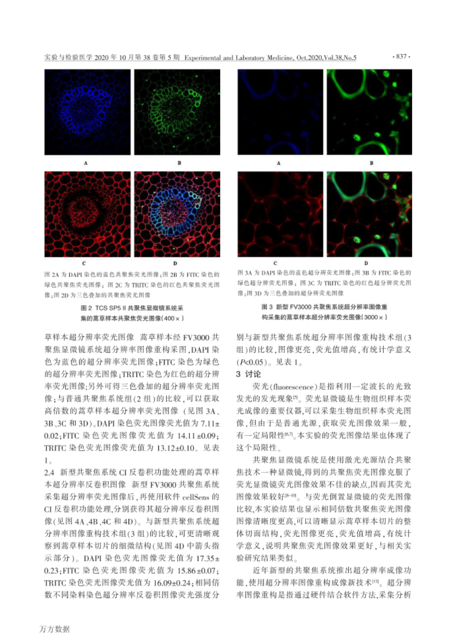 超分辨率图像重构与CI反卷积共聚焦成像技术对蒿草样_第3页