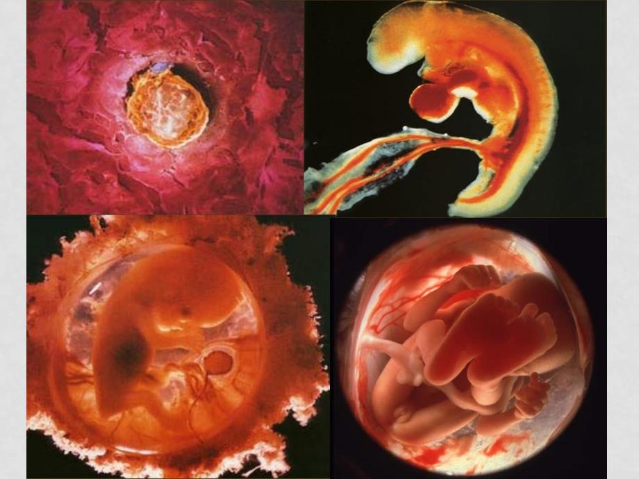 高中生物细胞的分化、衰老与癌变课件新人教版必修1_第4页