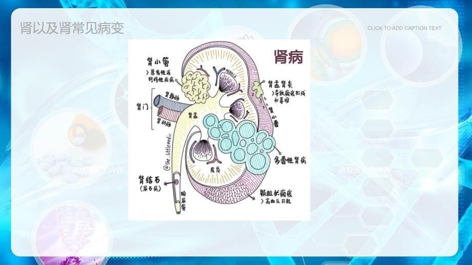 IgA肾病(教学示范PPT)_第5页