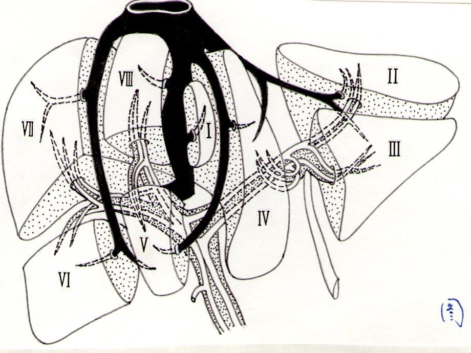肝内管道和肝段断层解剖讲座_第3页