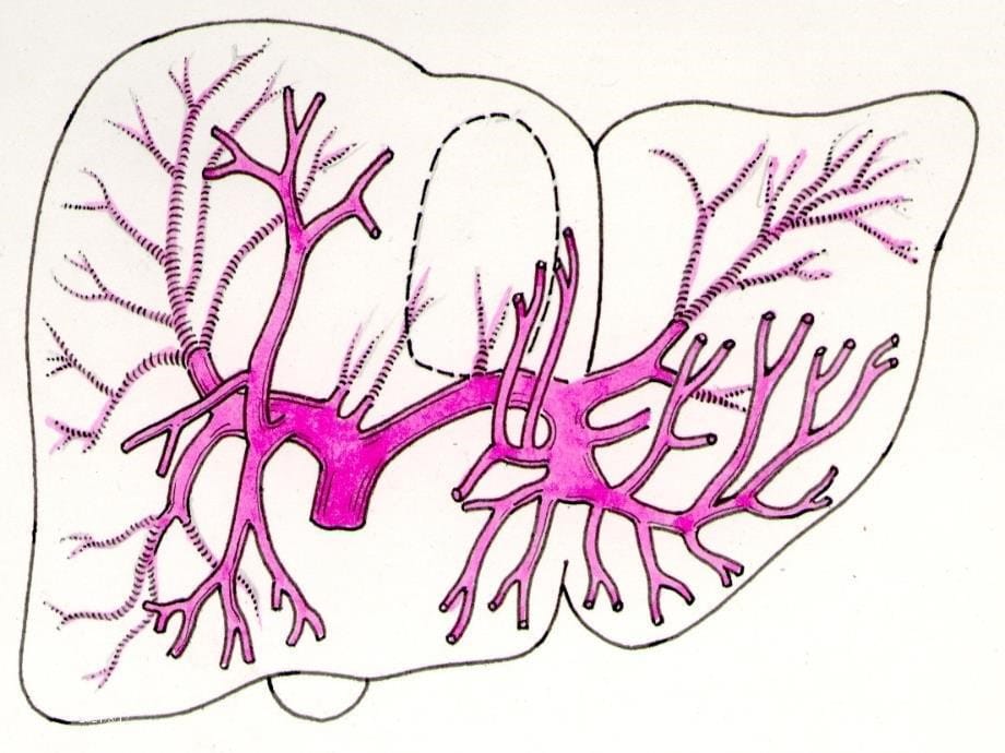 肝内管道和肝段断层解剖讲座_第5页