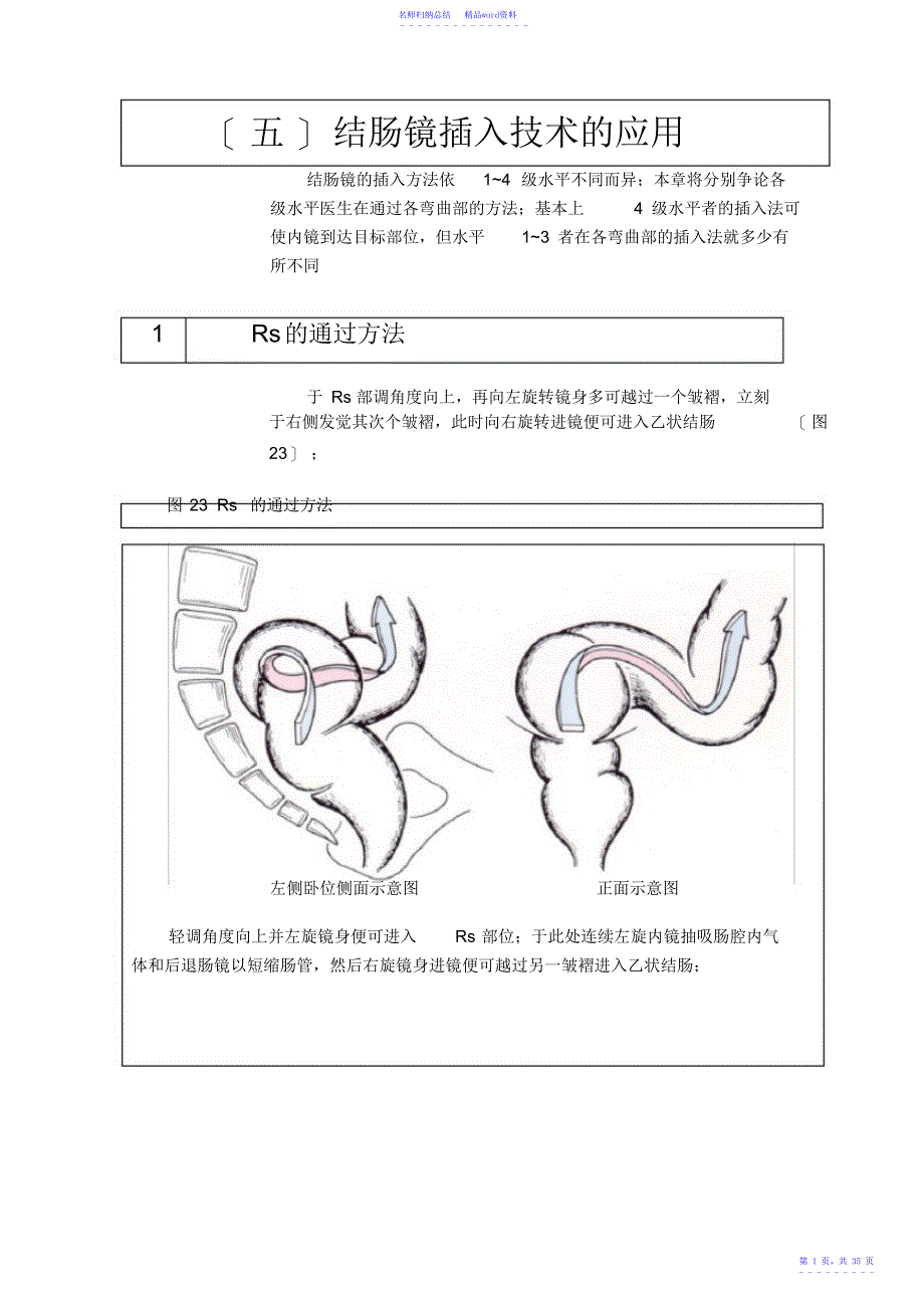 第五章结肠镜插入技术的应用_第1页