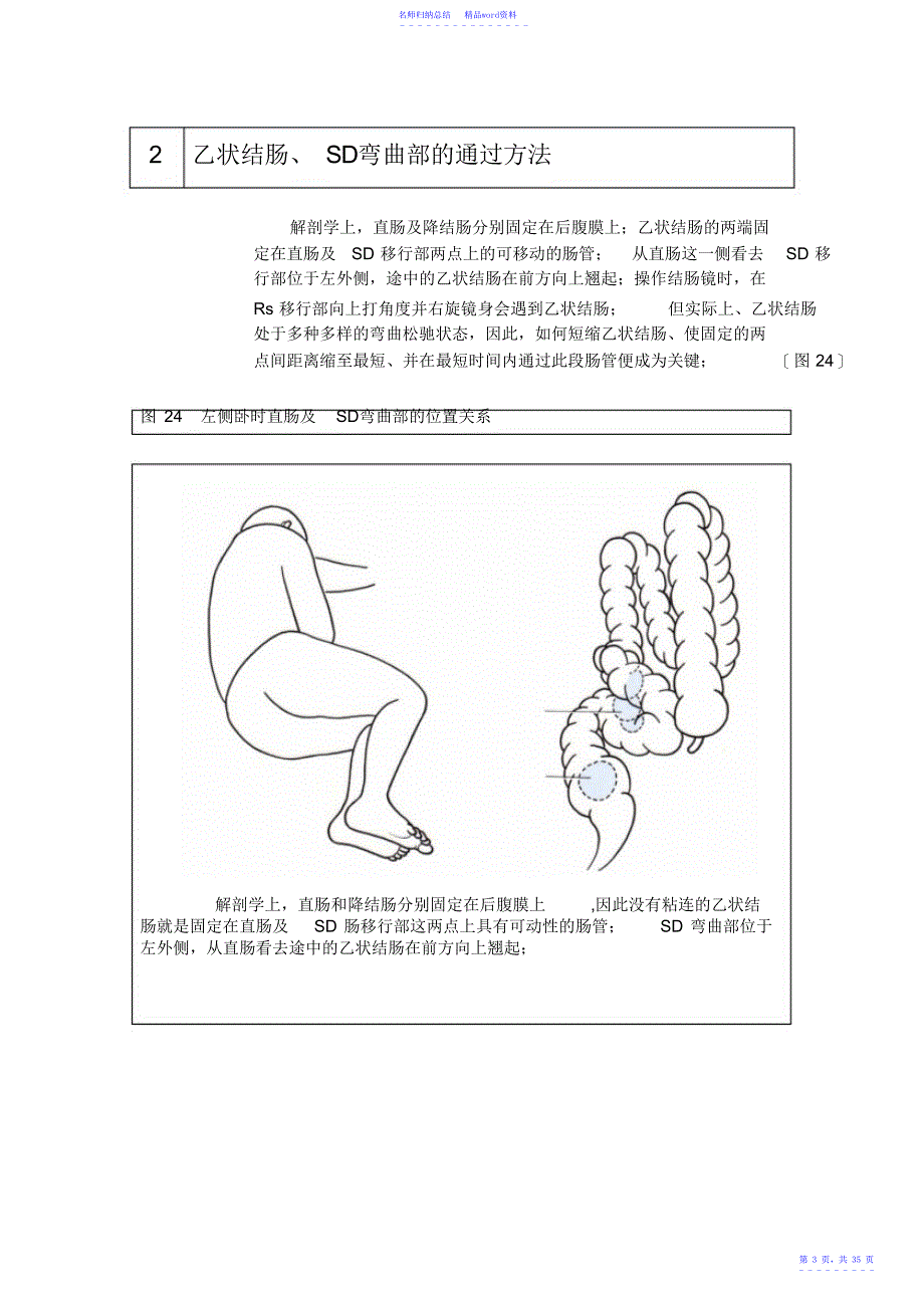 第五章结肠镜插入技术的应用_第3页