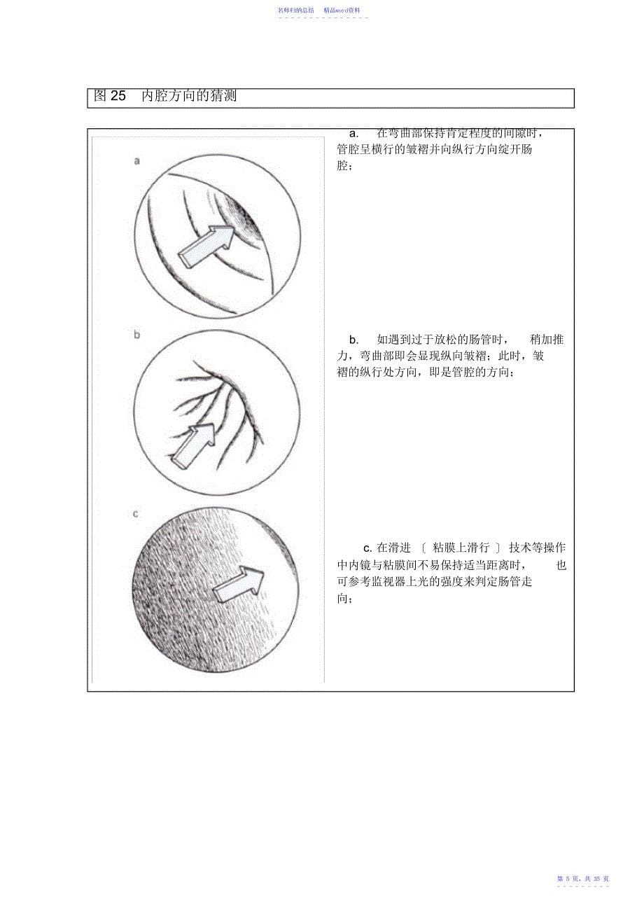 第五章结肠镜插入技术的应用_第5页