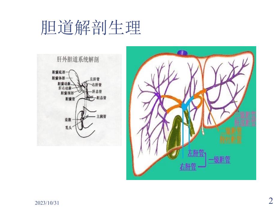 胆囊结石及其防治教学教案_第2页