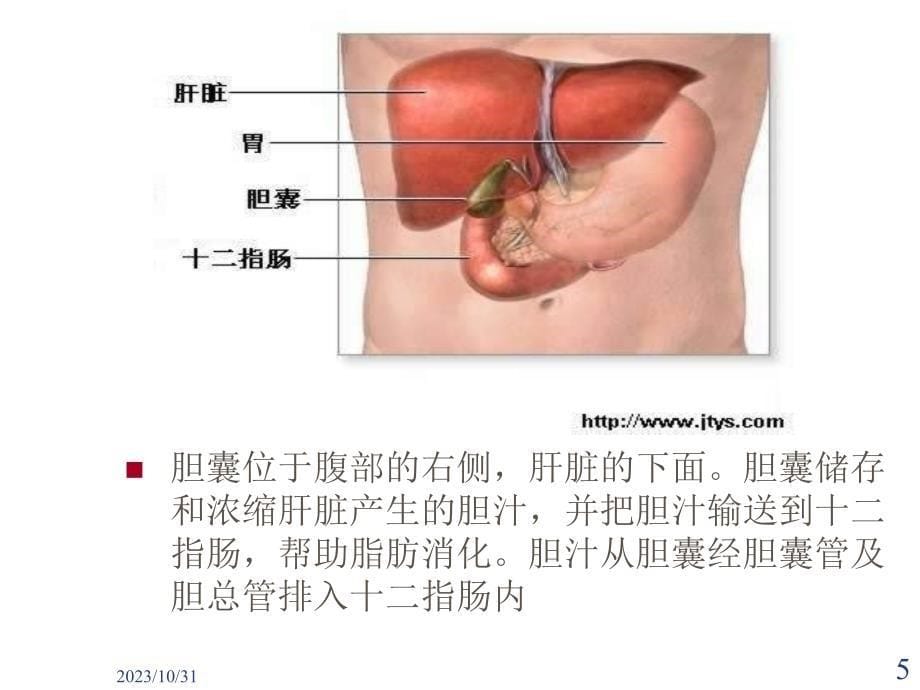 胆囊结石及其防治教学教案_第5页