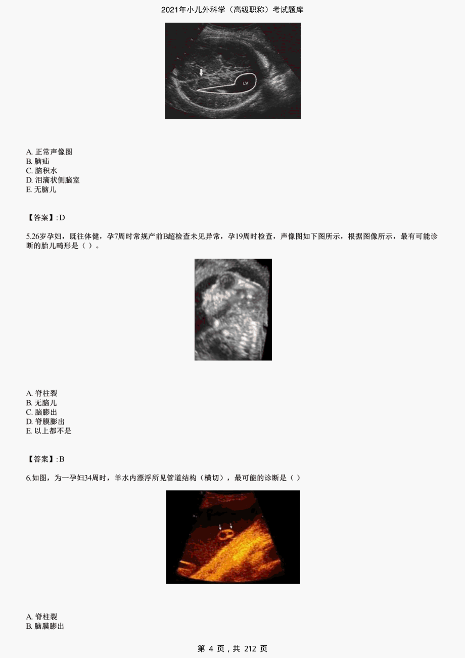 2021年小儿外科学（高级职称）考试题库-精编_第4页