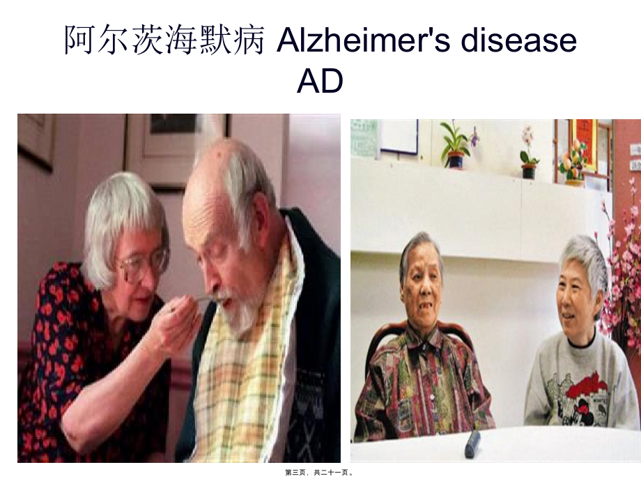 阿尔茨海默病 Alzheimer&ampamp;#039;s disease_第3页