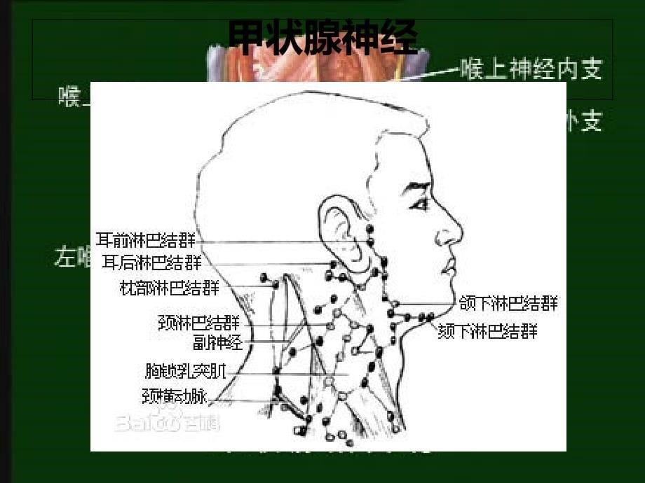 腔镜甲状腺术后病人的护理查房整理_第5页