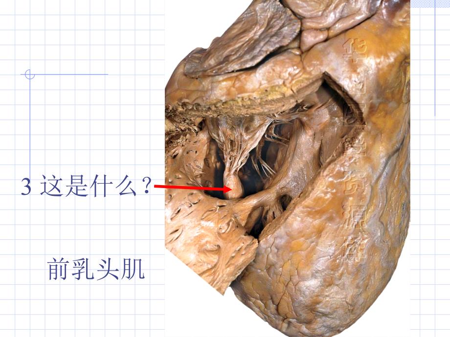 解剖标本考试收集_第3页