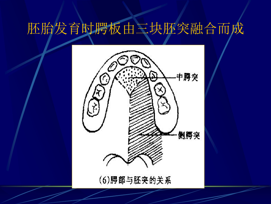 口腔颌面外科教材课件第十二章先天性唇腭裂与面裂_第5页