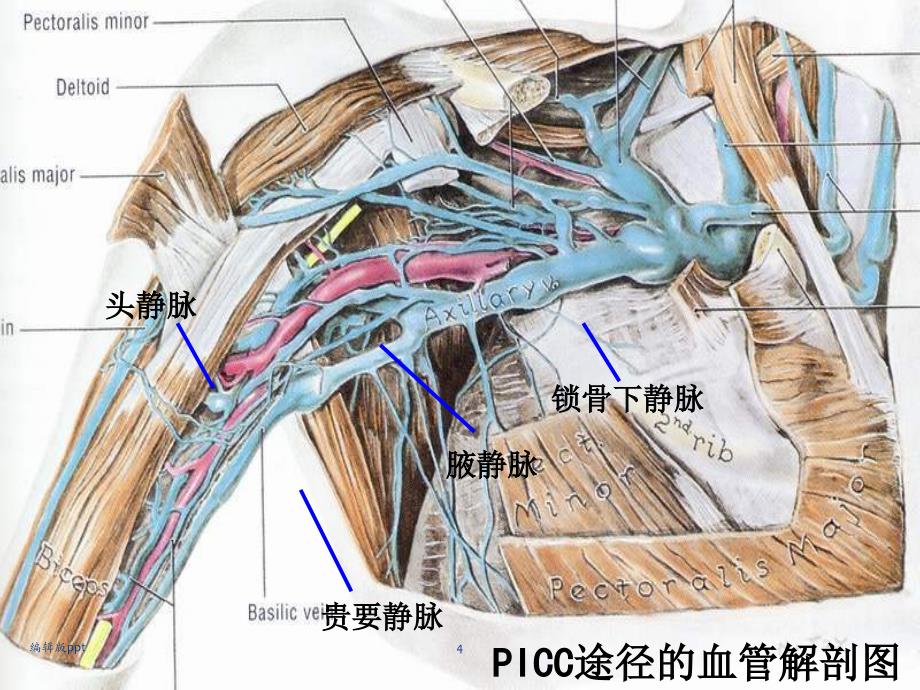 PICC置管术PPT课件_第4页