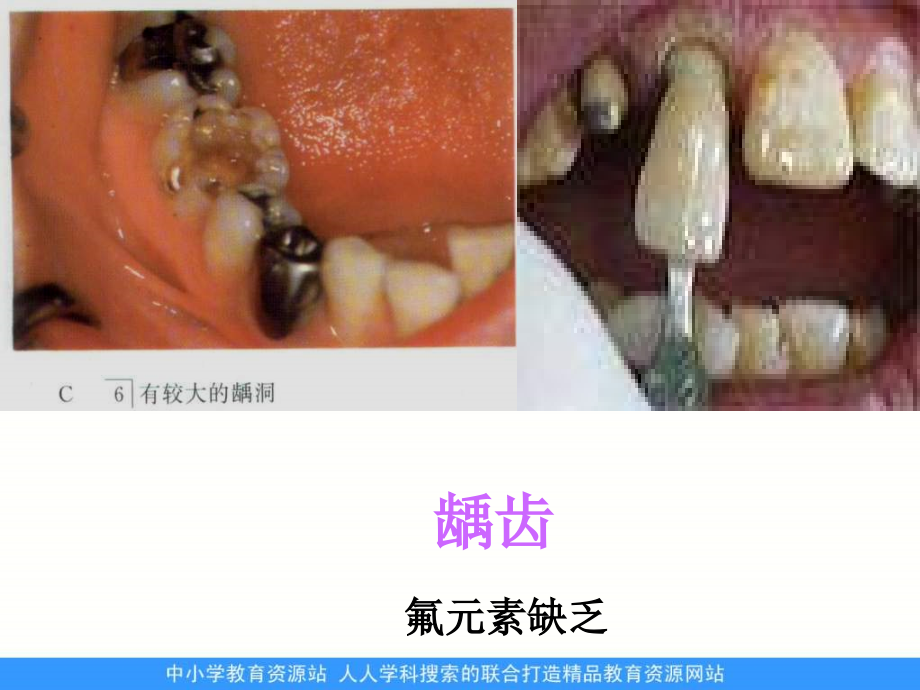 人教版化学九下《化学元素与人体健康》ppt课件4资料_第3页