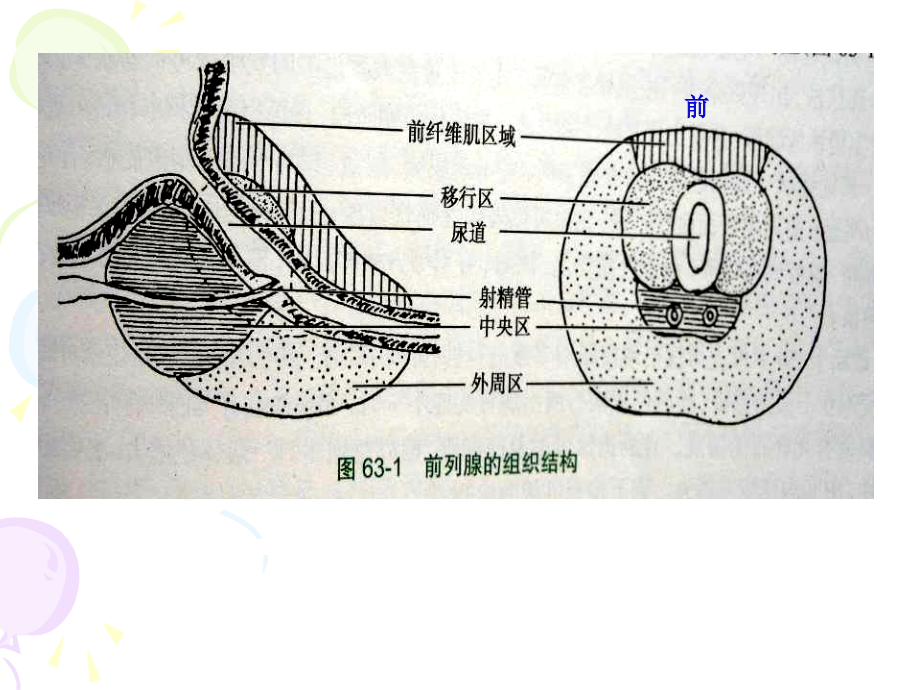 临床病理学课件：前列腺疾病_第4页