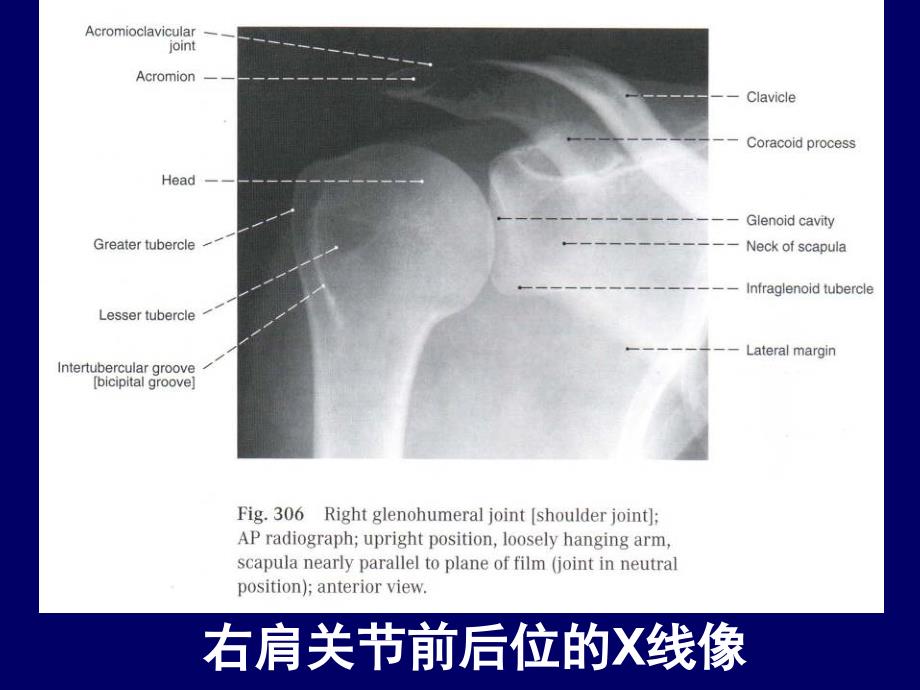 医学课件人体断层解剖学上肢的断层解剖_第2页