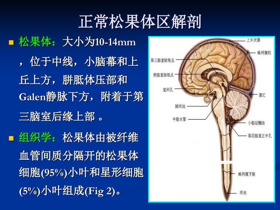 松果体区病变影像诊断PPT课件_第2页